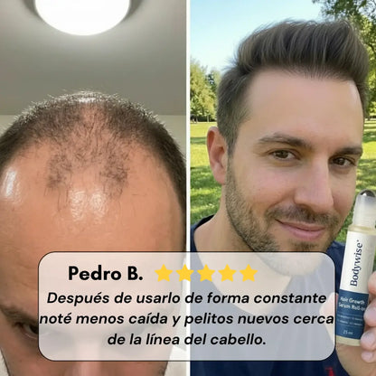 Bodywise® – Serum Capilar de Crecimiento Intensivo