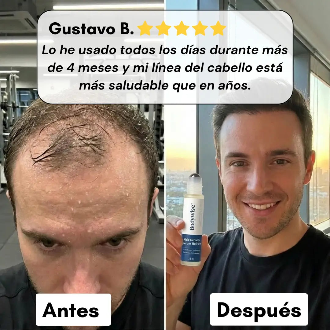 Bodywise® – Serum Capilar de Crecimiento Intensivo