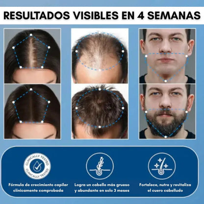 Bodywise® – Serum Capilar de Crecimiento Intensivo