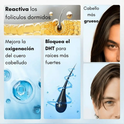 Bodywise® – Serum Capilar de Crecimiento Intensivo