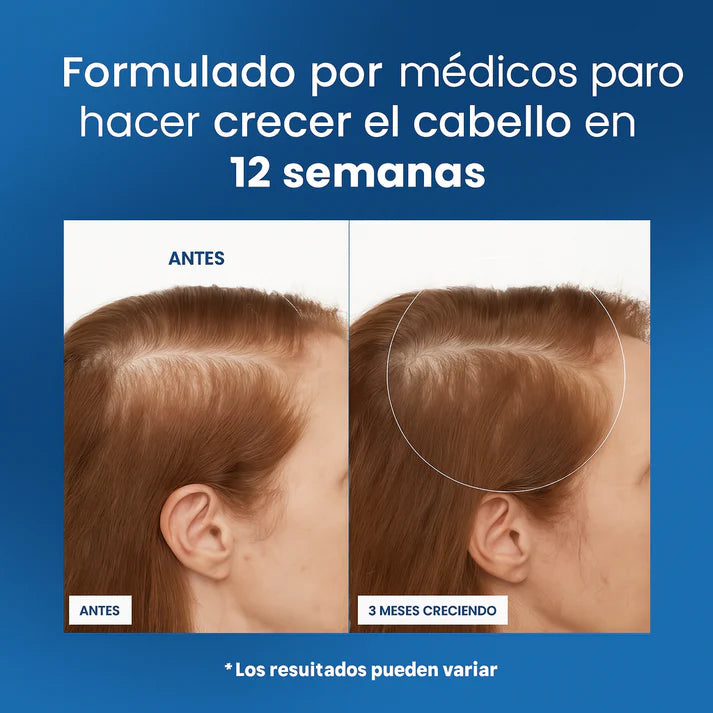 Bodywise® – Serum Capilar de Crecimiento Intensivo