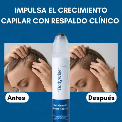 Bodywise® – Serum Capilar de Crecimiento Intensivo