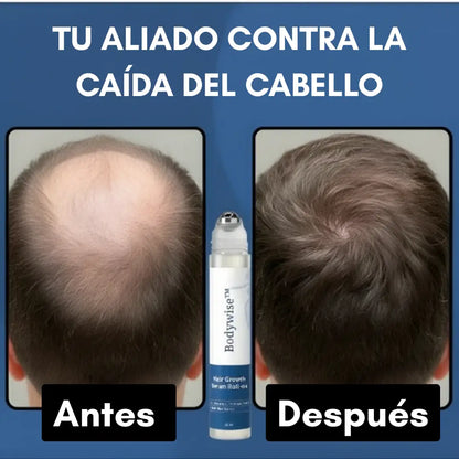 Bodywise® – Serum Capilar de Crecimiento Intensivo